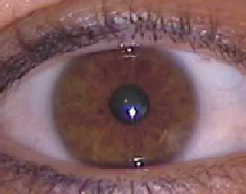 eye02